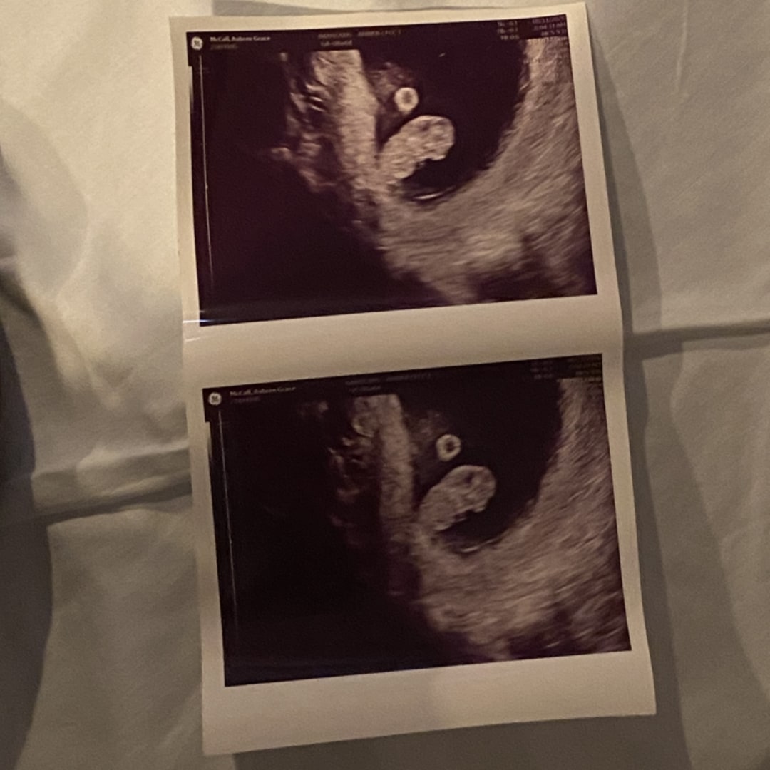 Photo shared by Aubree for their Babylist baby registry.