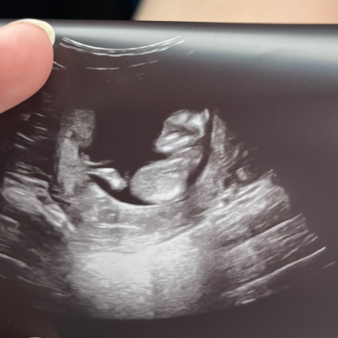 Photo shared by Ashlynn for their Babylist baby registry.