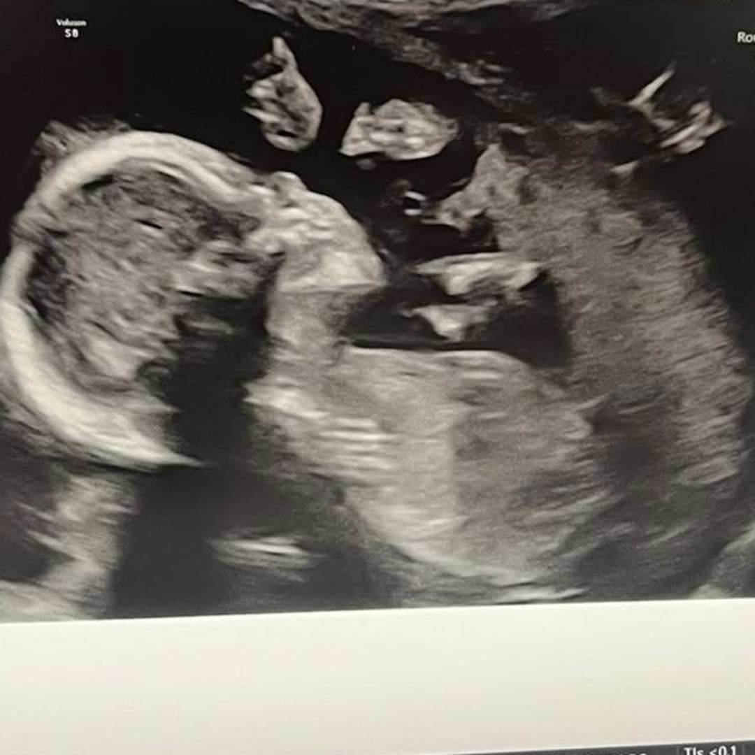 Photo shared by Brianna for their Babylist baby registry.
