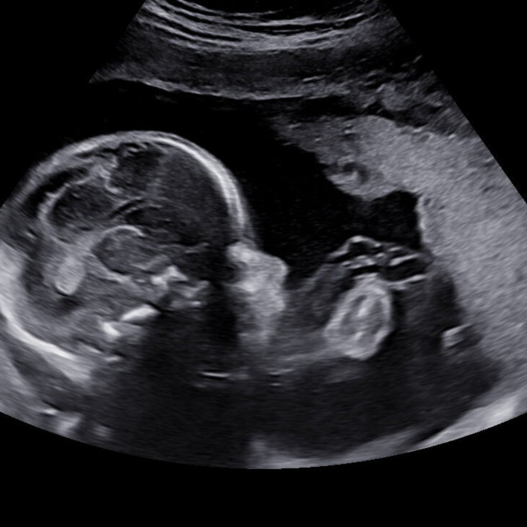 Photo shared by Payton for their Babylist baby registry.