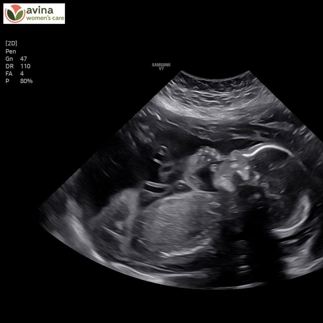 Photo shared by Jamie for their Babylist baby registry.