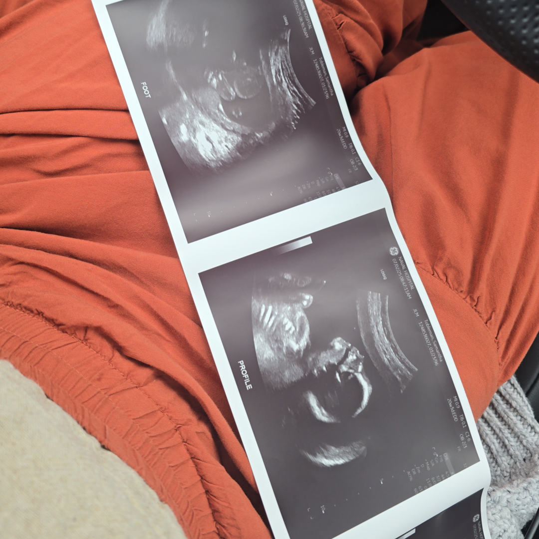 Photo shared by Samantha for their Babylist baby registry.