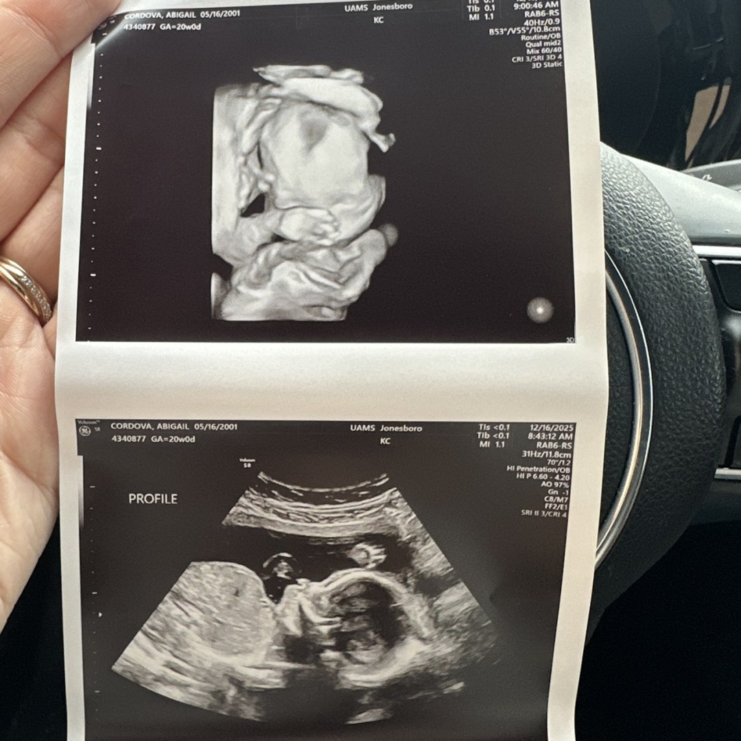 Photo shared by Abigail for their Babylist baby registry.