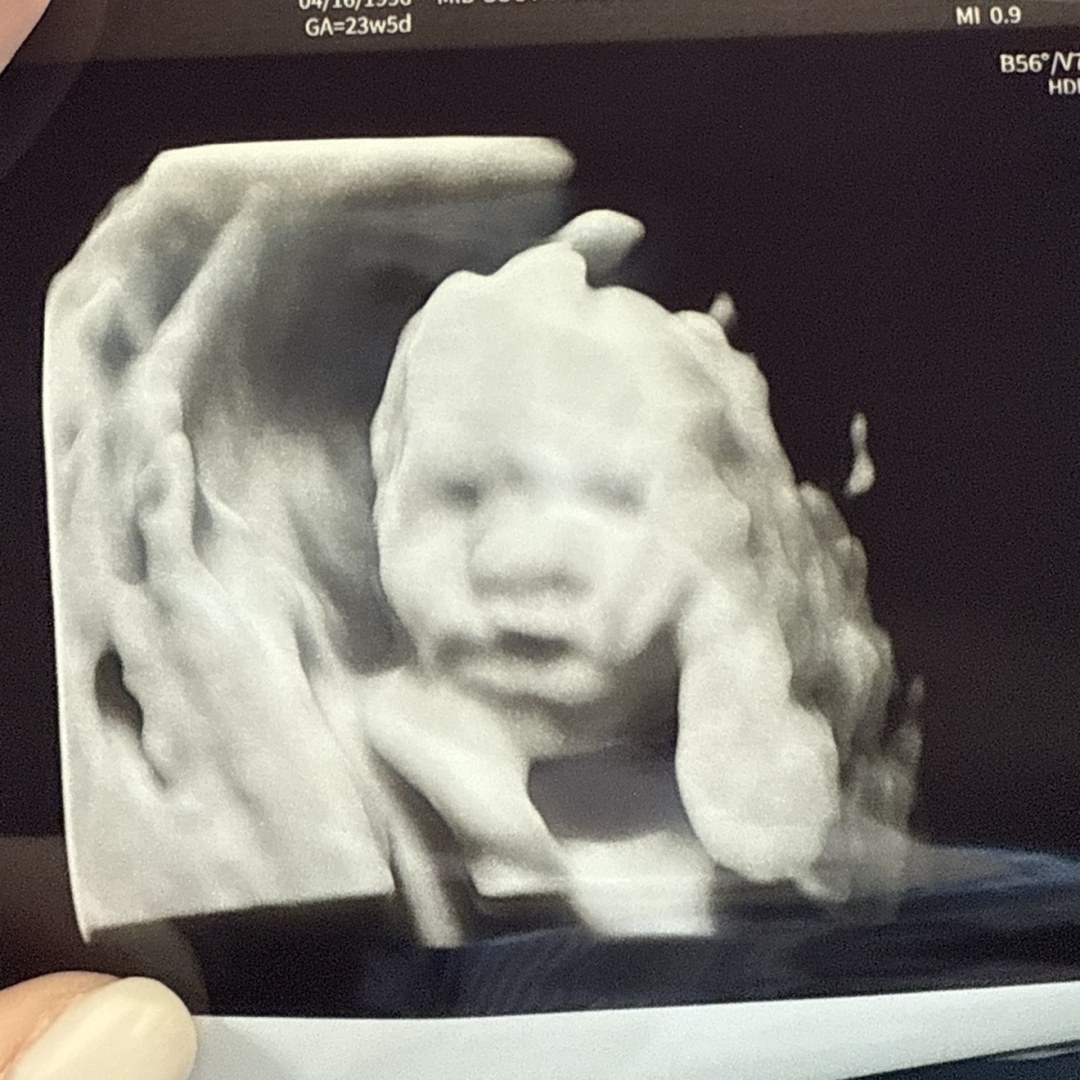Photo shared by Hannah for their Babylist baby registry.
