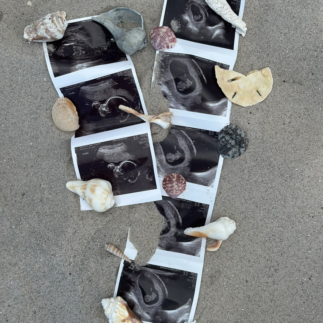 Photo shared by Darby for their Babylist baby registry.