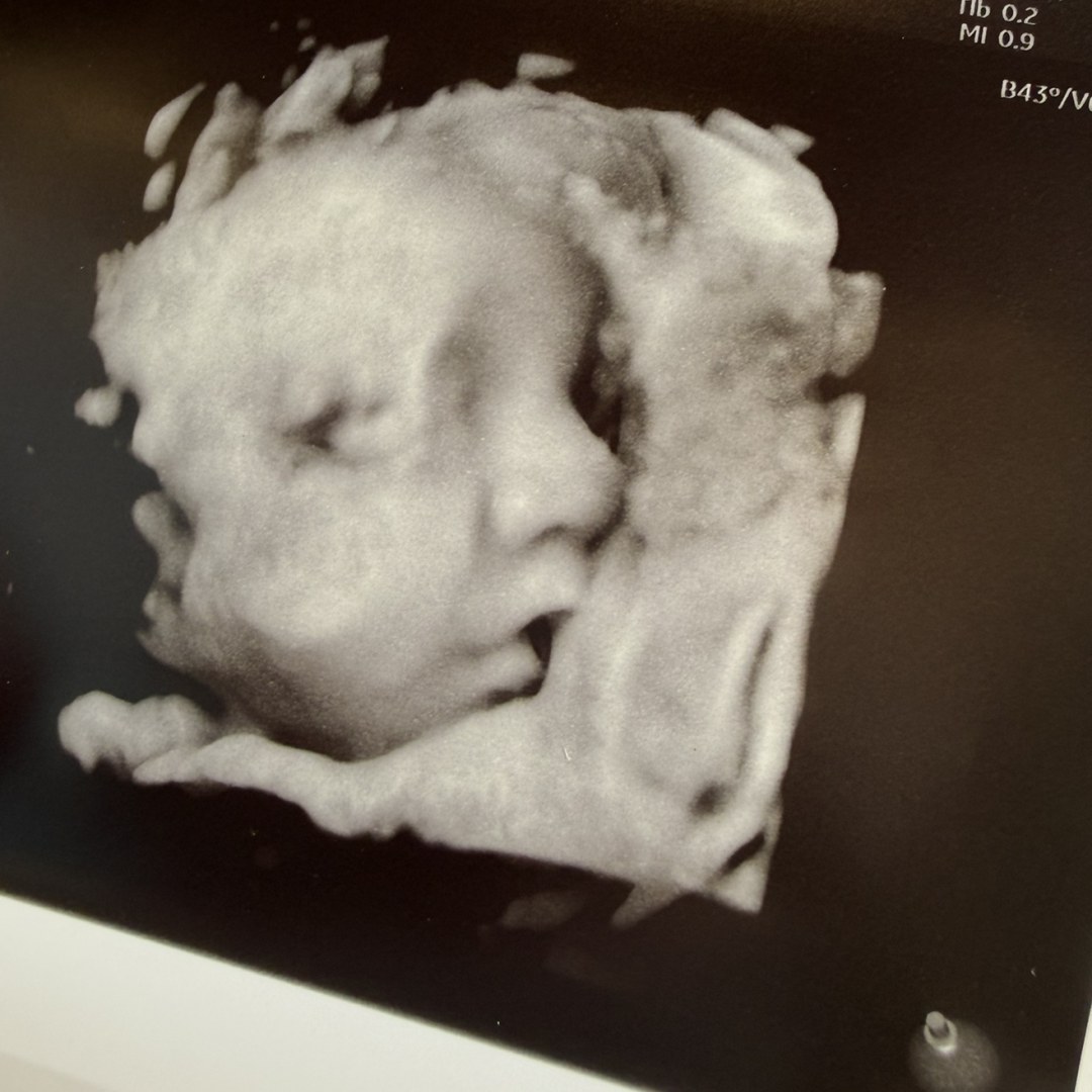 Photo shared by Makayla for their Babylist baby registry.