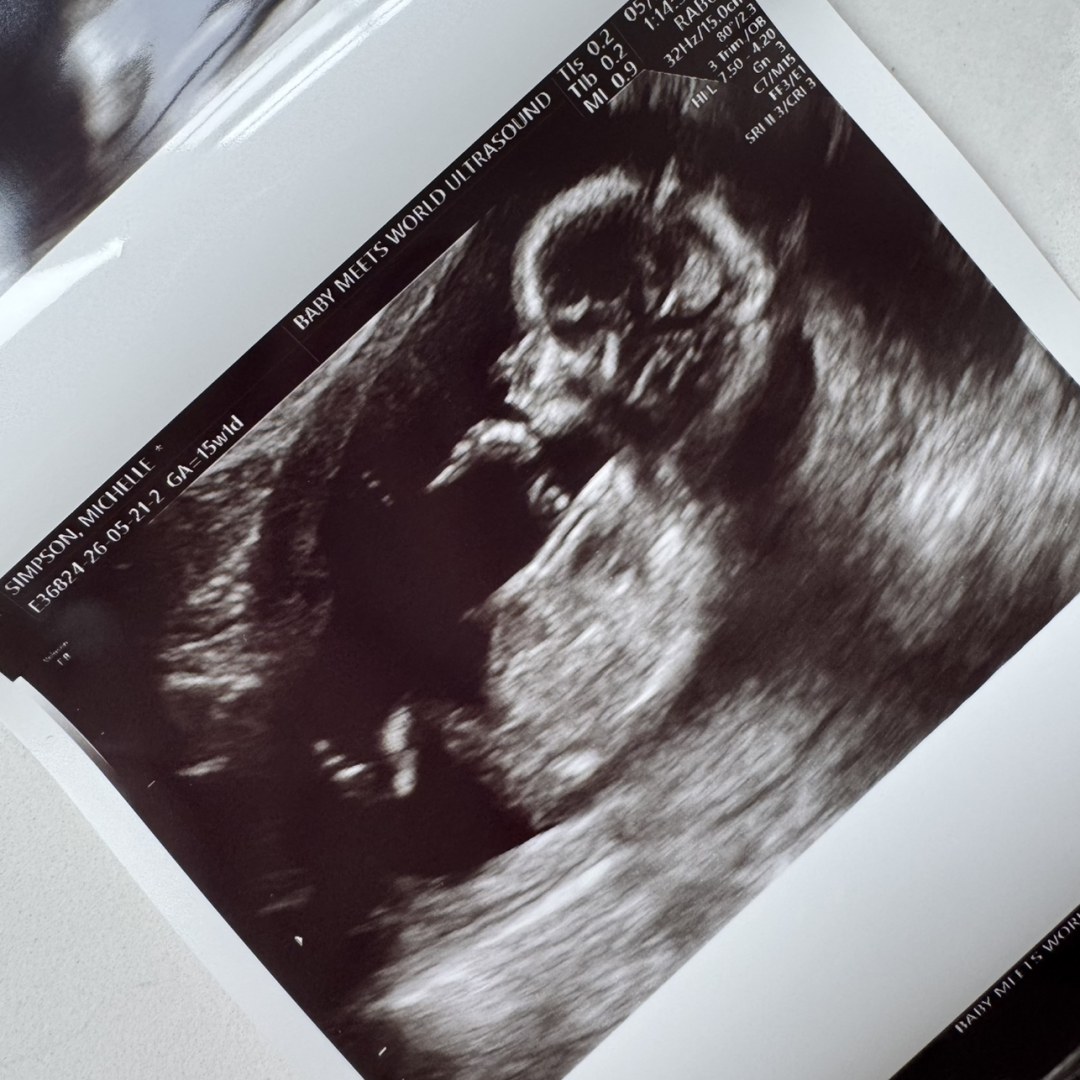 Photo shared by Michelle for their Babylist baby registry.