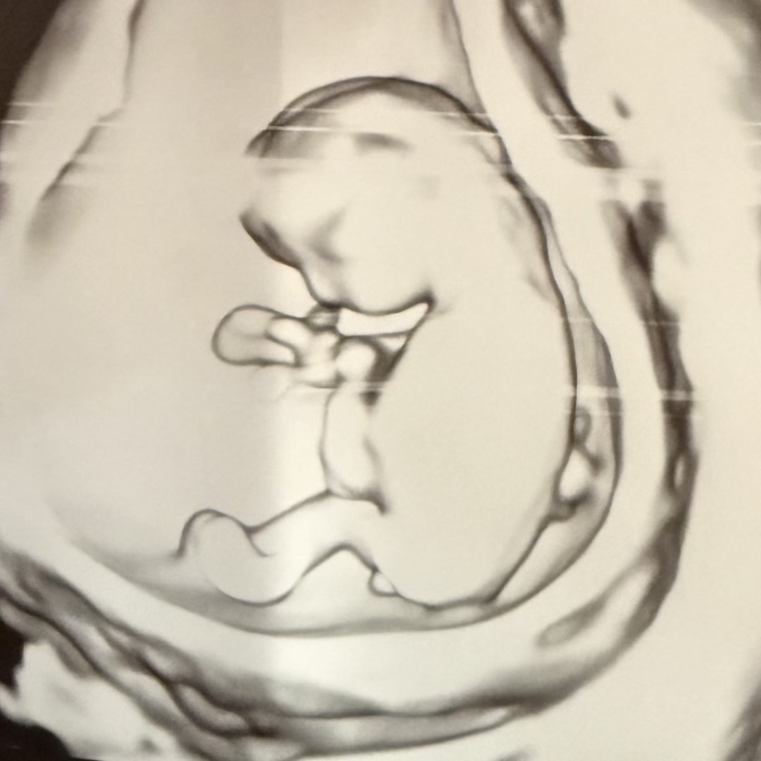 Photo shared by Arianna for their Babylist baby registry.