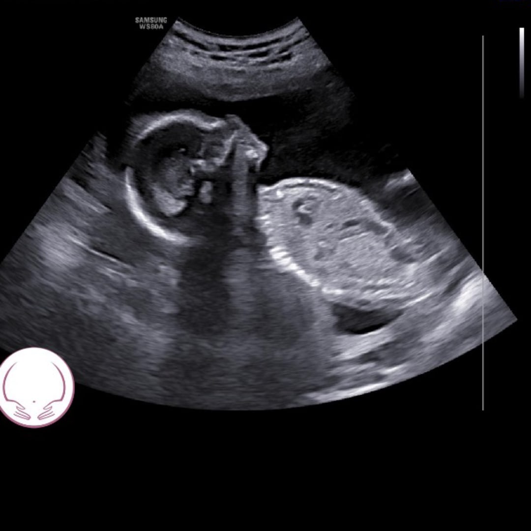 Photo shared by Karli for their Babylist baby registry.