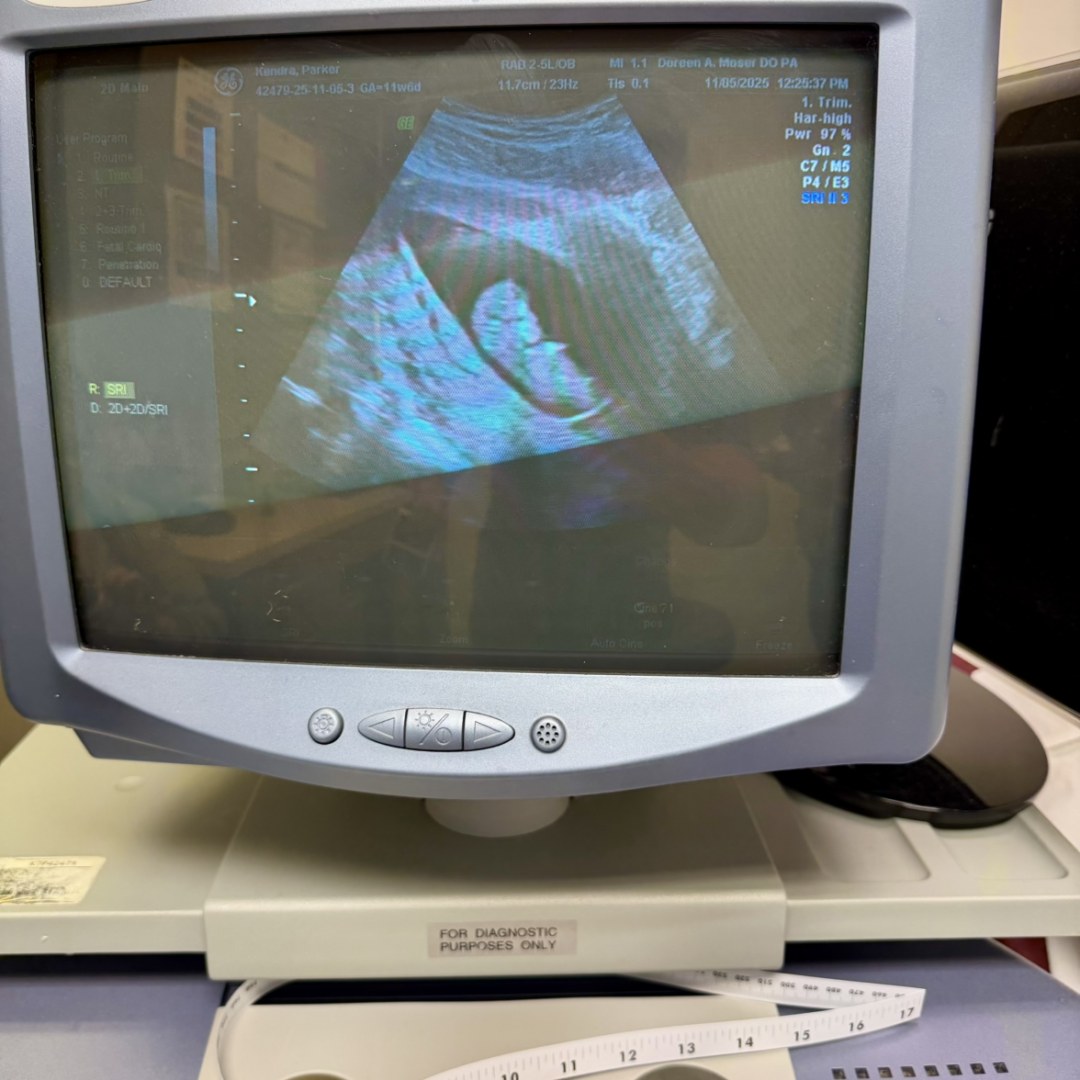 Photo shared by Kendra for their Babylist baby registry.