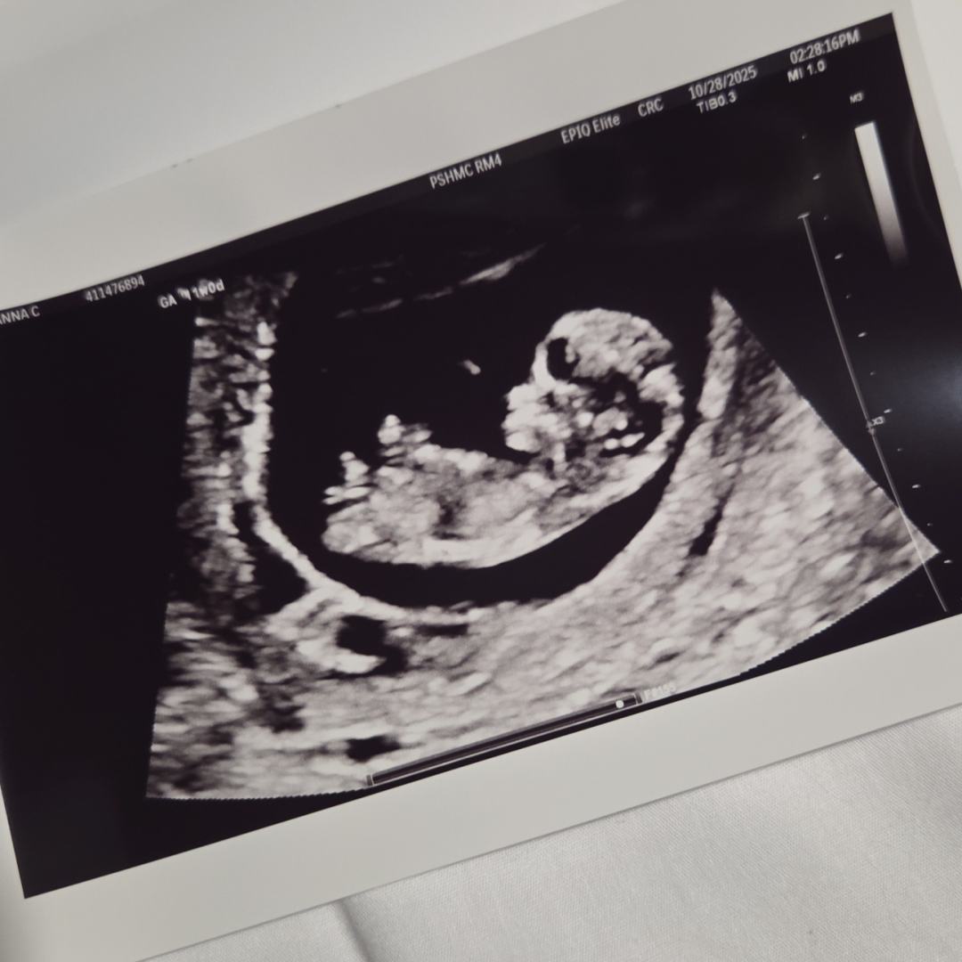 Photo shared by Brianna for their Babylist baby registry.