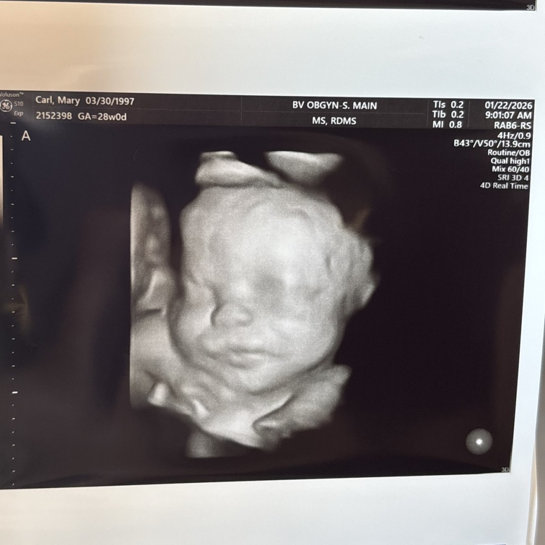 Photo shared by Abbey for their Babylist baby registry.