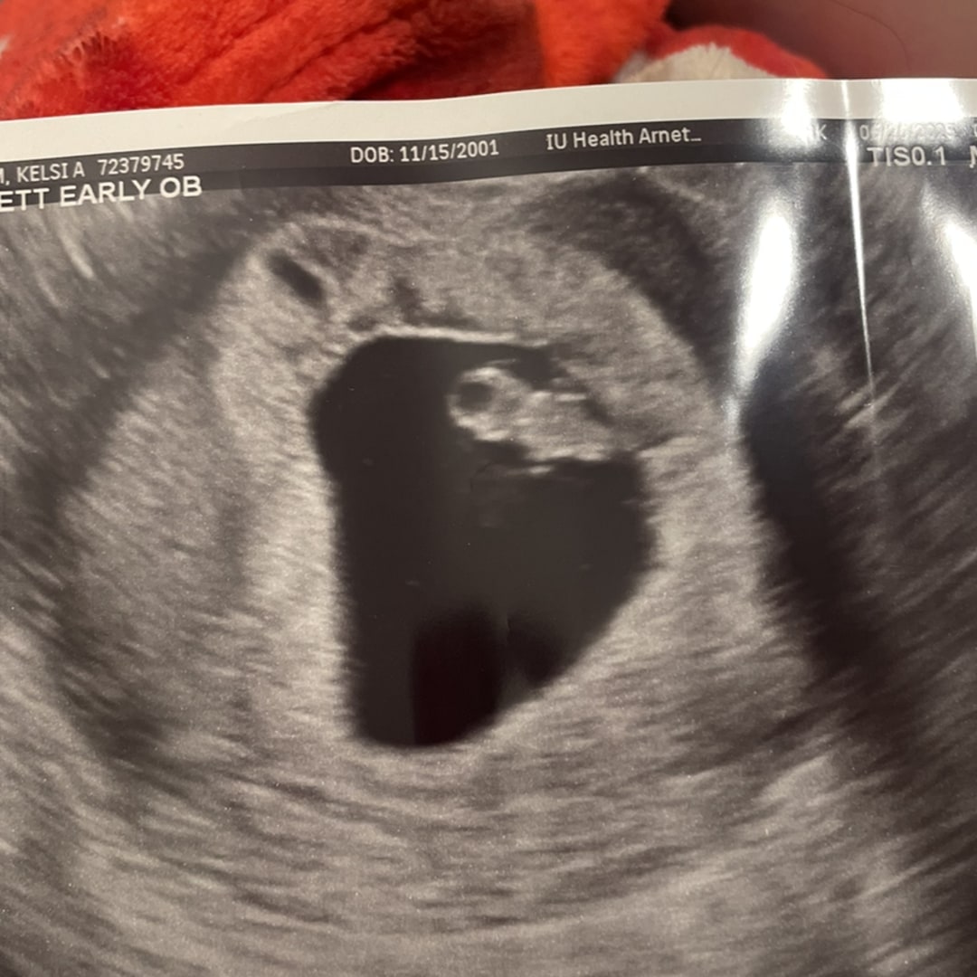 Photo shared by Kelsi for their Babylist baby registry.