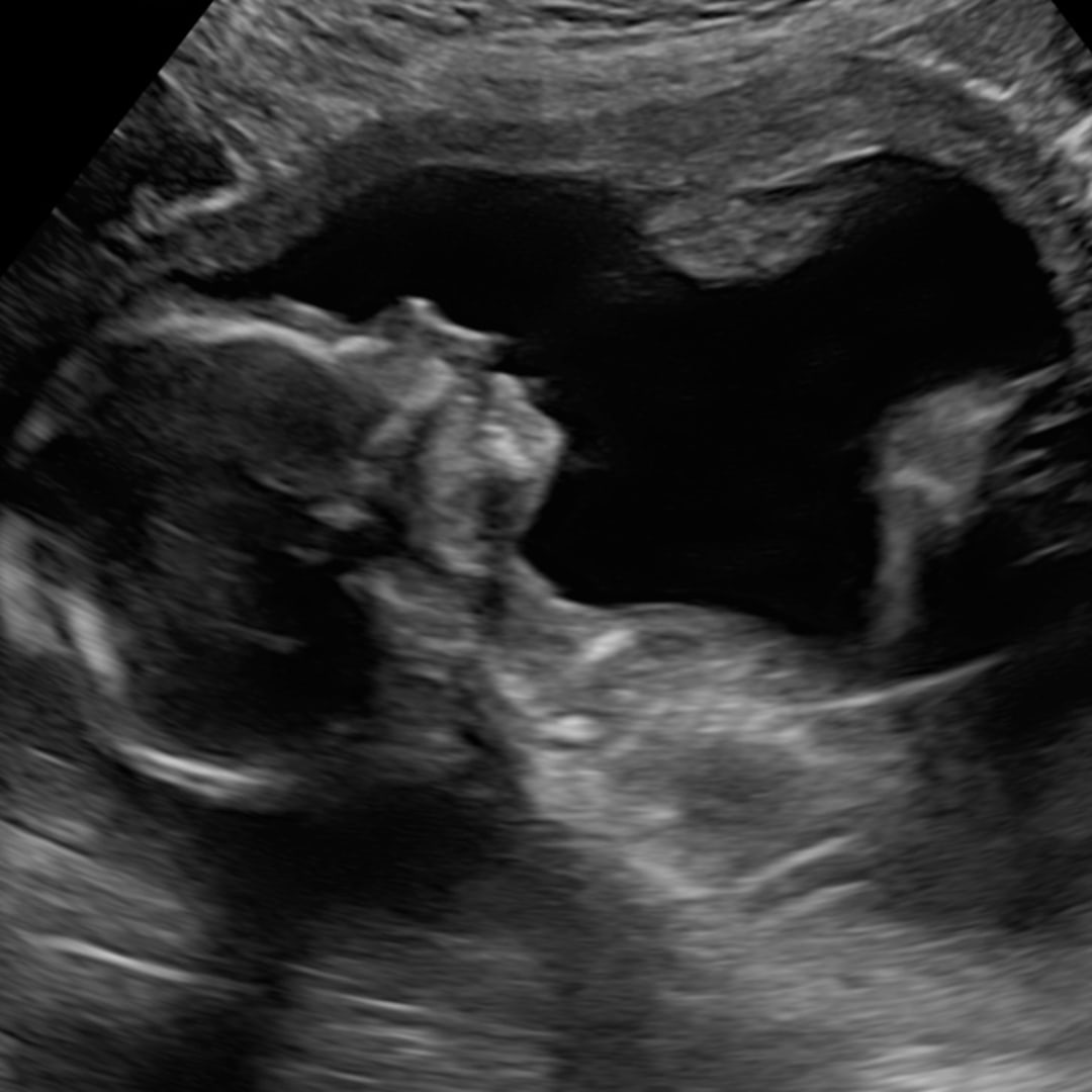 Photo shared by Christa for their Babylist baby registry.