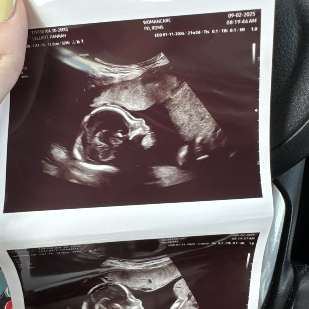 Photo shared by Hannah for their Babylist baby registry.