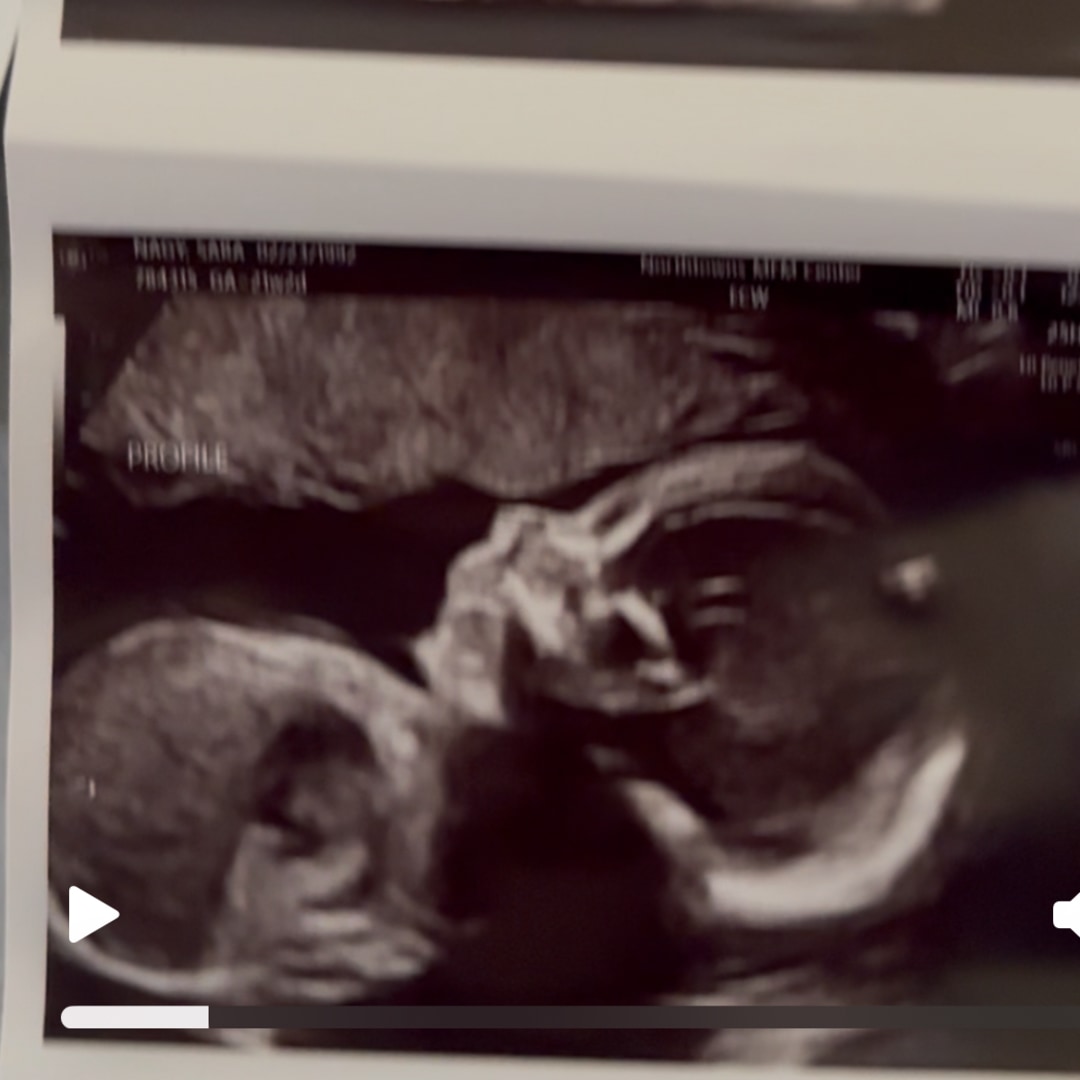 Photo shared by Sara for their Babylist baby registry.
