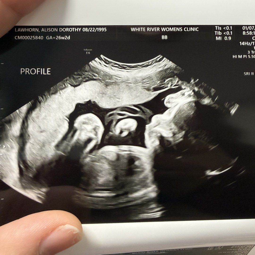 Photo shared by Alison for their Babylist baby registry.