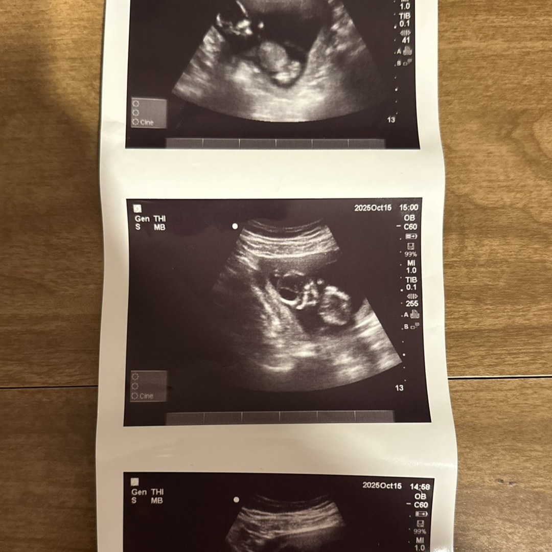 Photo shared by Lydia for their Babylist baby registry.