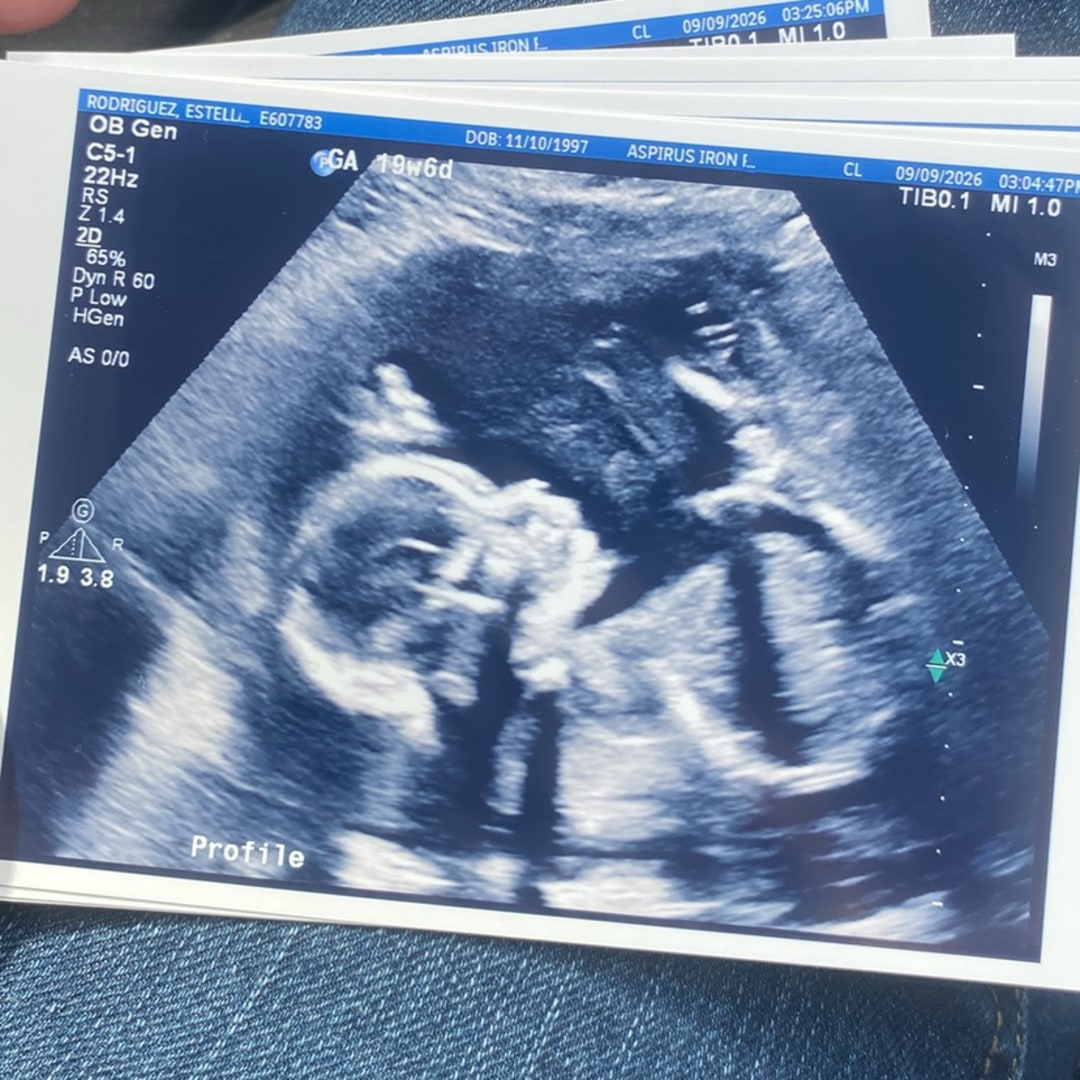 Photo shared by Estella for their Babylist baby registry.