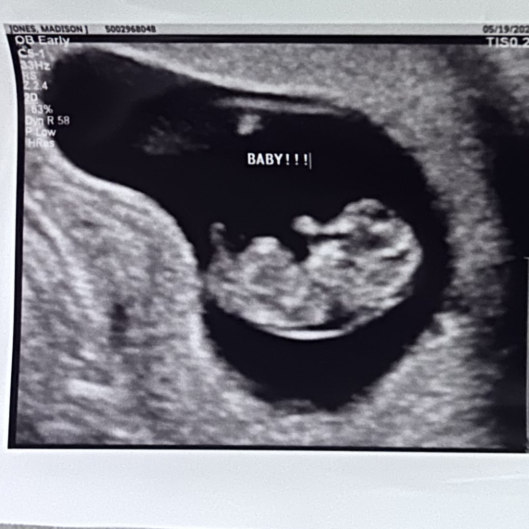 Photo shared by Madison for their Babylist baby registry.