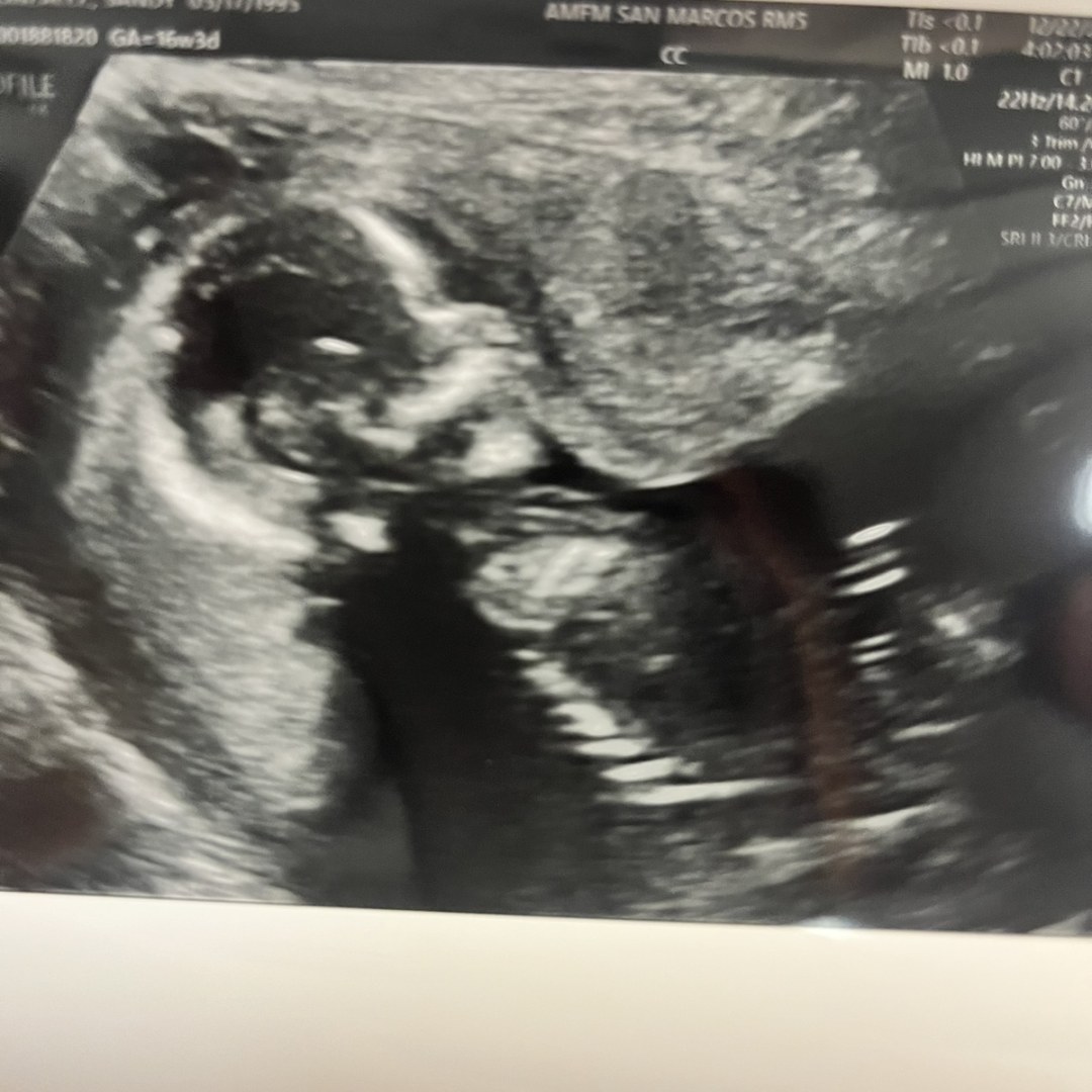 Photo shared by Sandy for their Babylist baby registry.