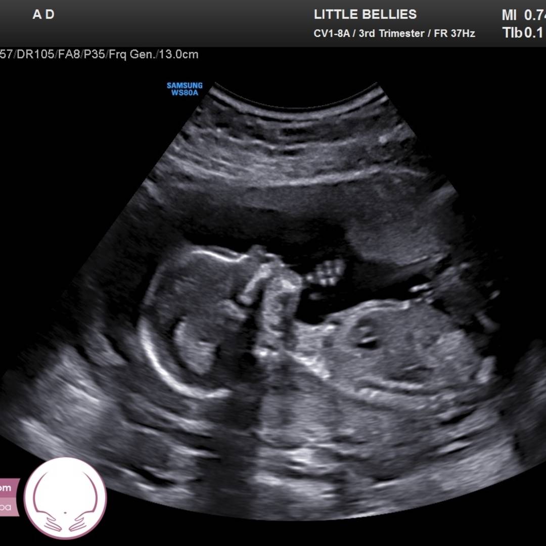 Photo shared by Ashley for their Babylist baby registry.