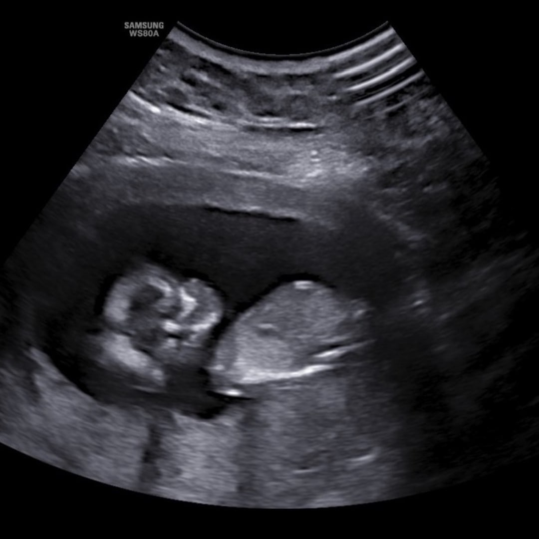 Photo shared by Amber for their Babylist baby registry.