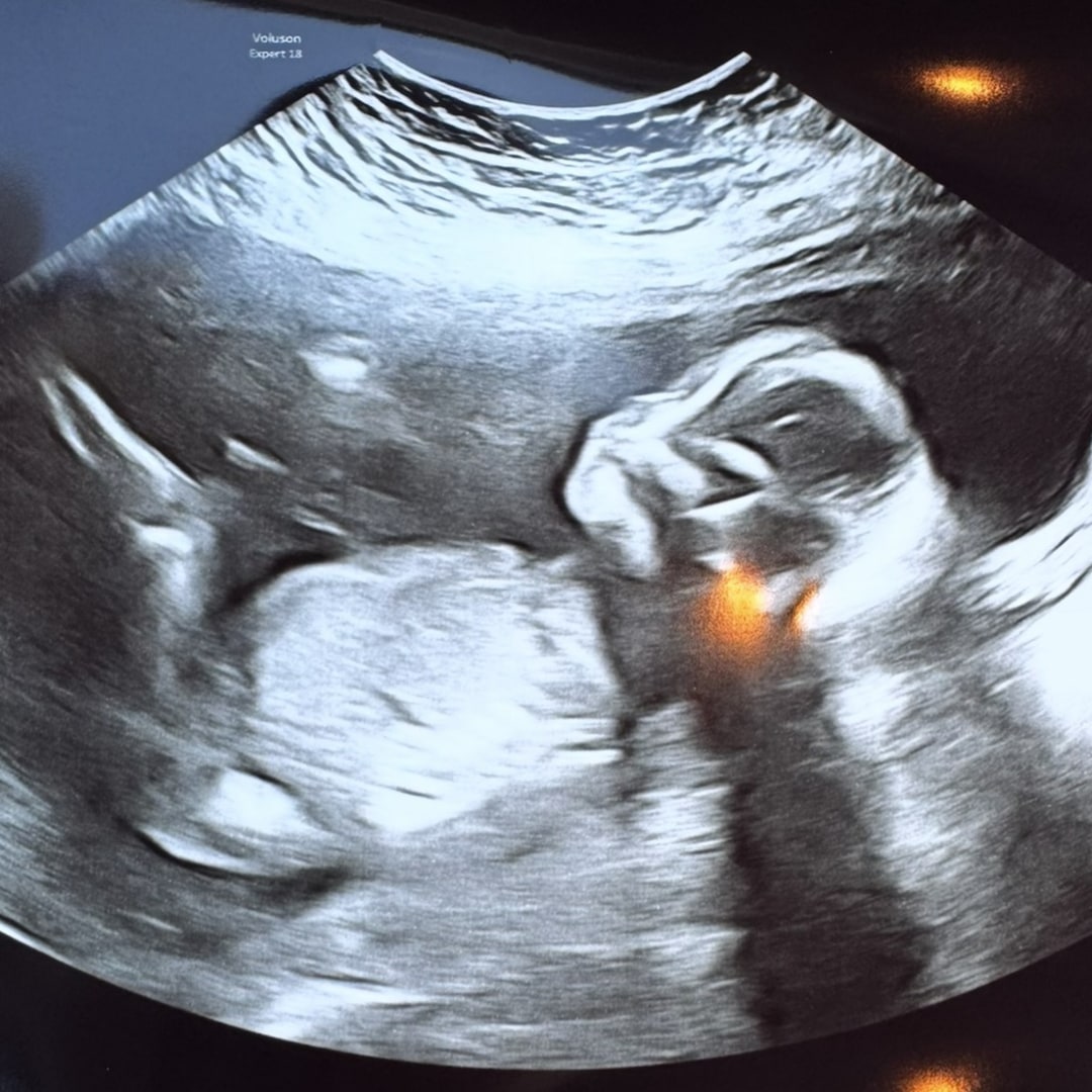 Photo shared by Greg for their Babylist baby registry.