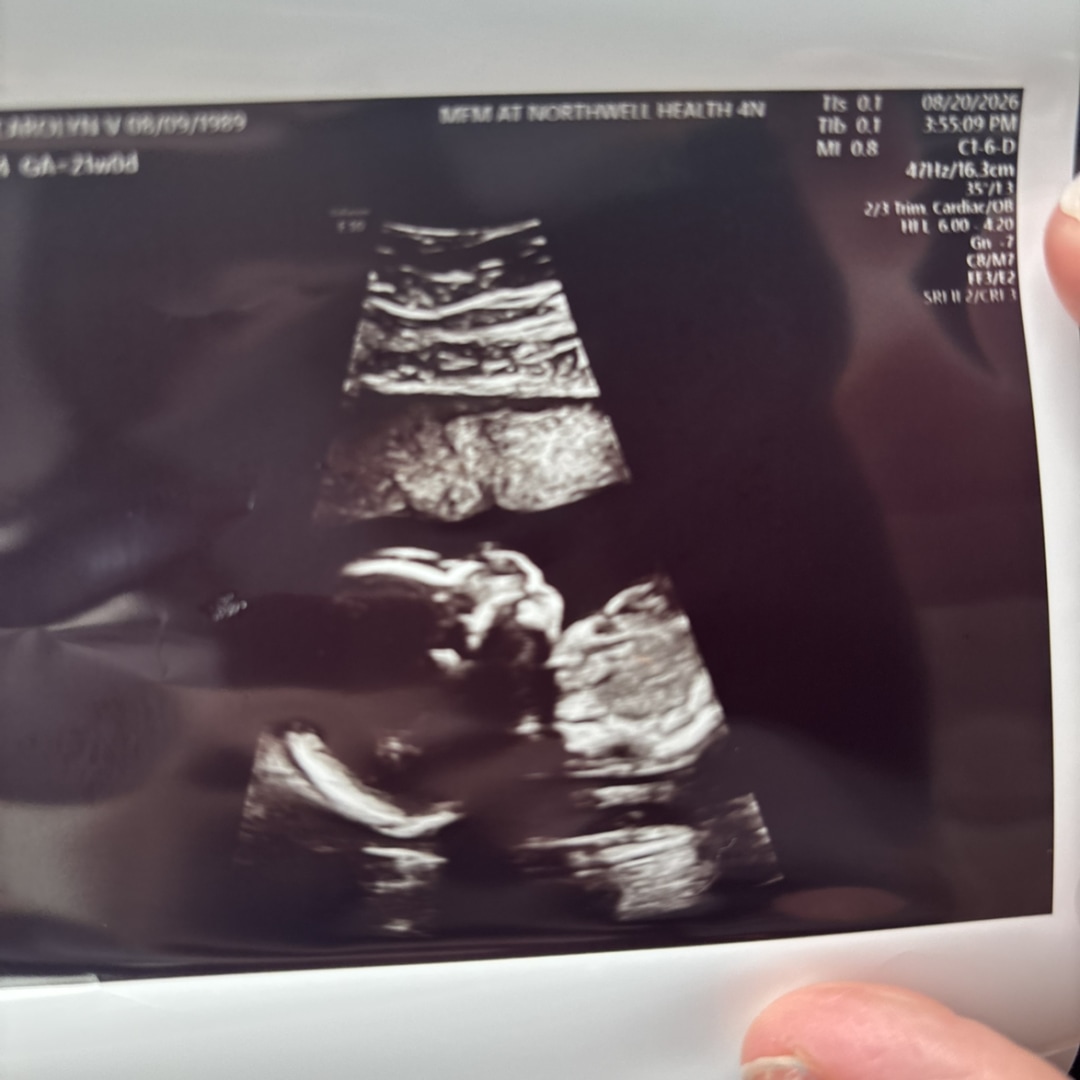 Photo shared by Carolyn for their Babylist baby registry.