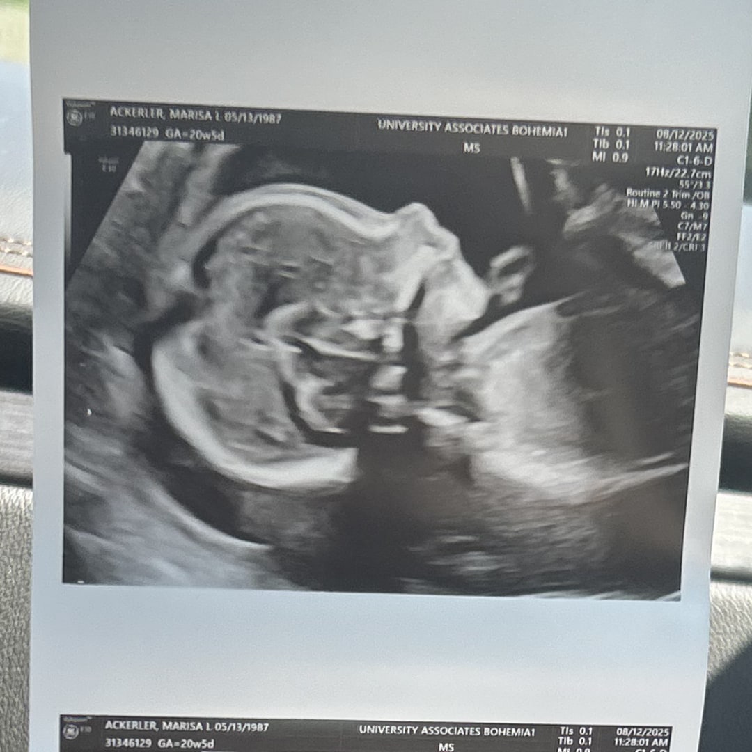 Photo shared by Marisa for their Babylist baby registry.