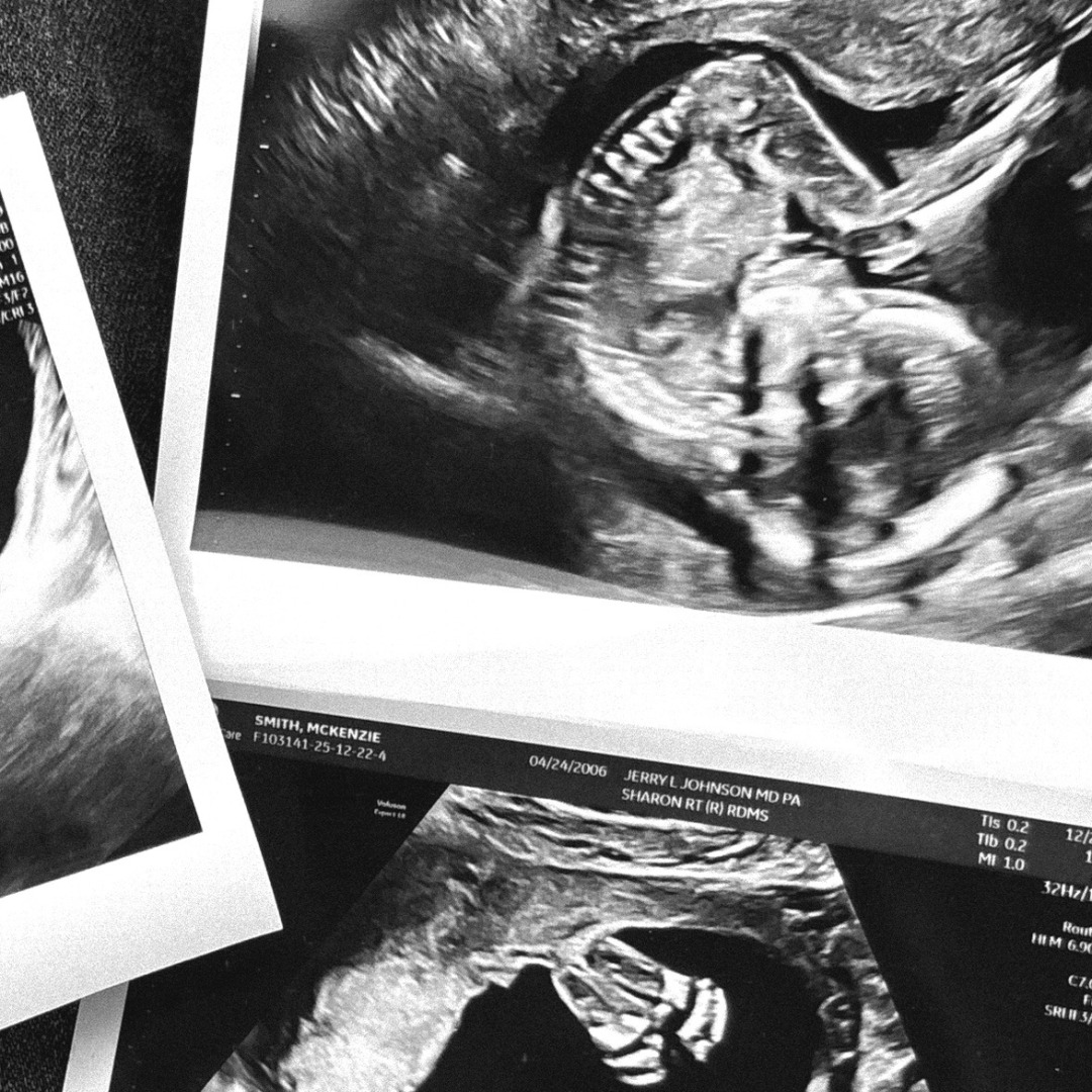 Photo shared by Mckenzie for their Babylist baby registry.