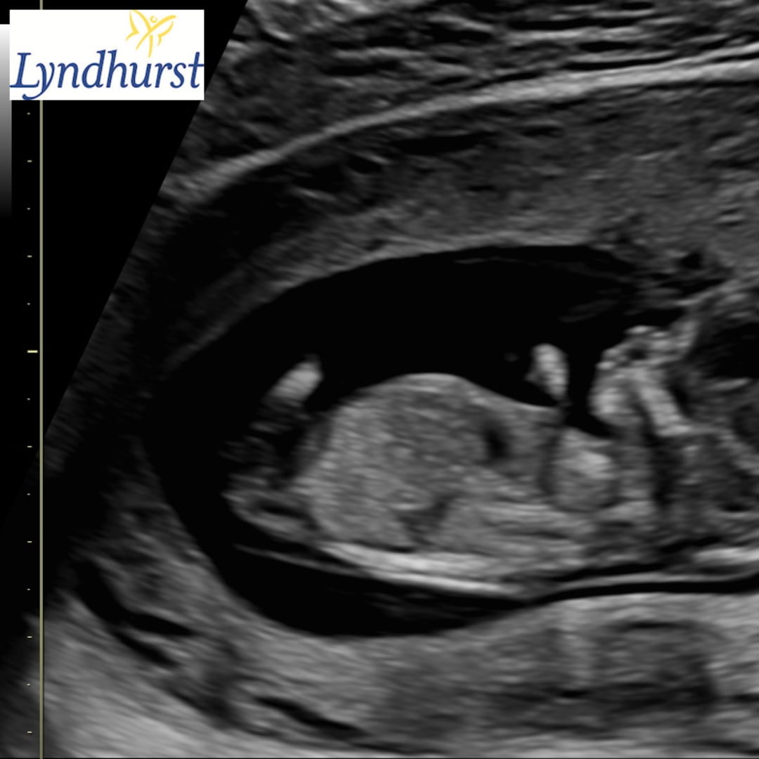 Photo shared by Kendra for their Babylist baby registry.