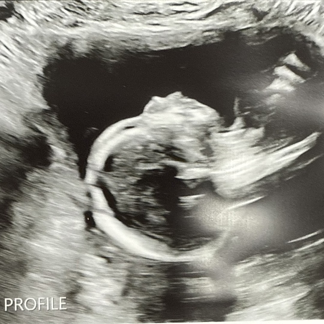 Photo shared by Katie for their Babylist baby registry.