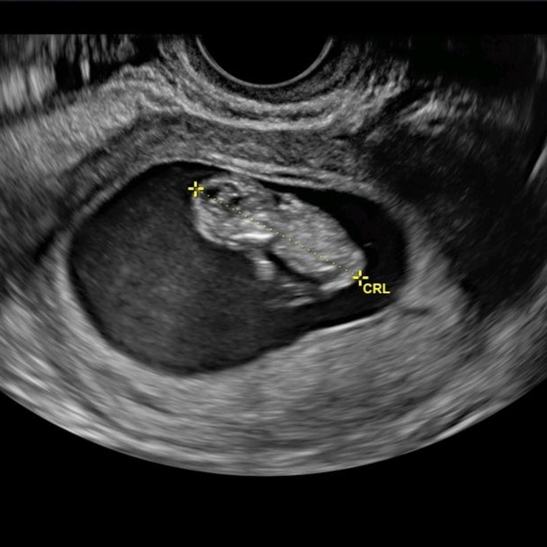 Photo shared by Amber for their Babylist baby registry.