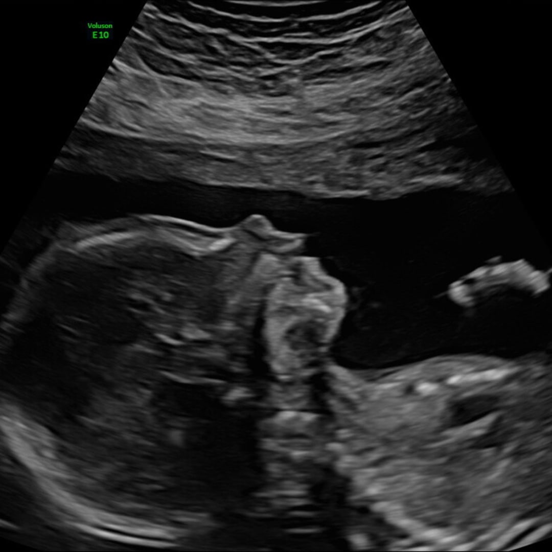 Photo shared by Hannah for their Babylist baby registry.