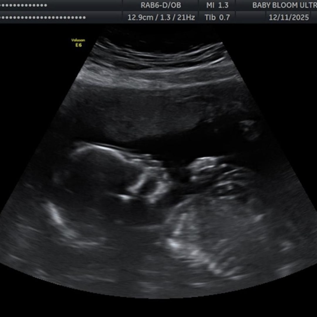 Photo shared by Bri for their Babylist baby registry.