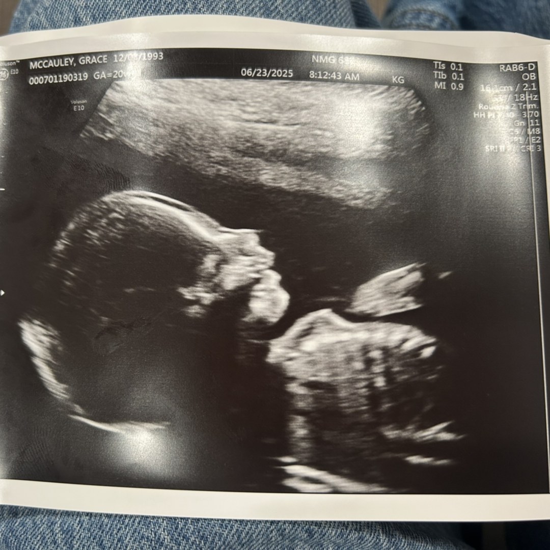 Photo shared by Grace for their Babylist baby registry.