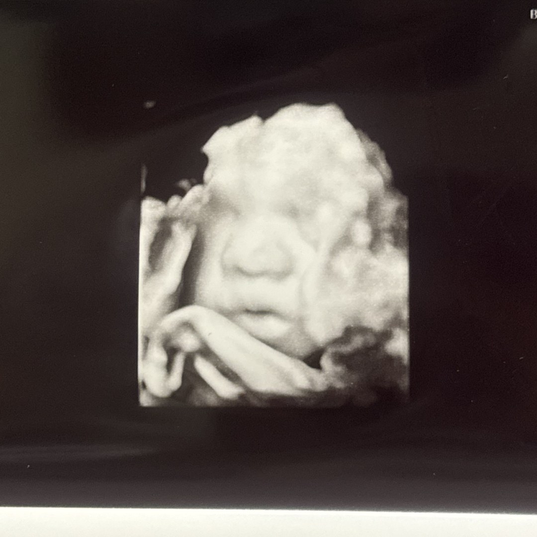 Photo shared by Isa for their Babylist baby registry.