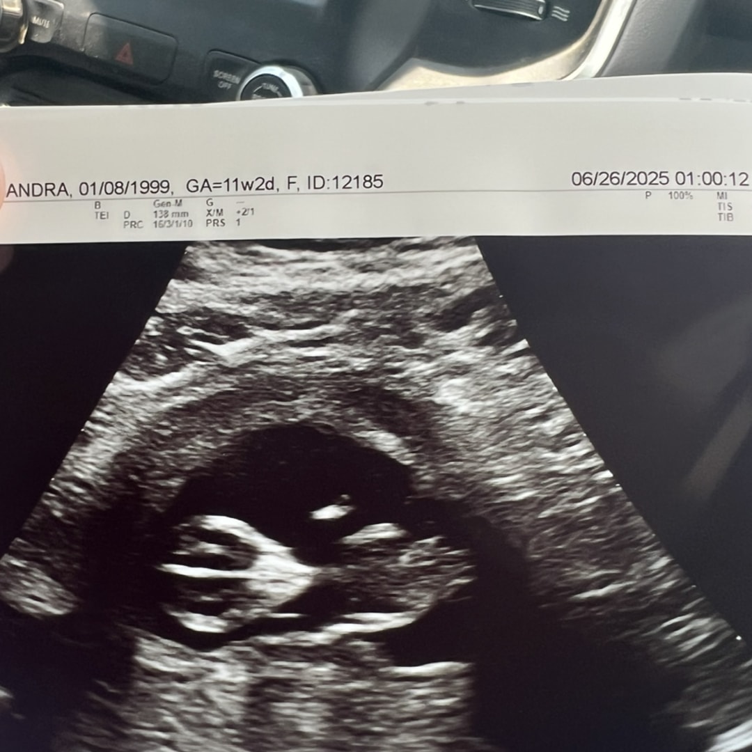 Photo shared by Cassy for their Babylist baby registry.