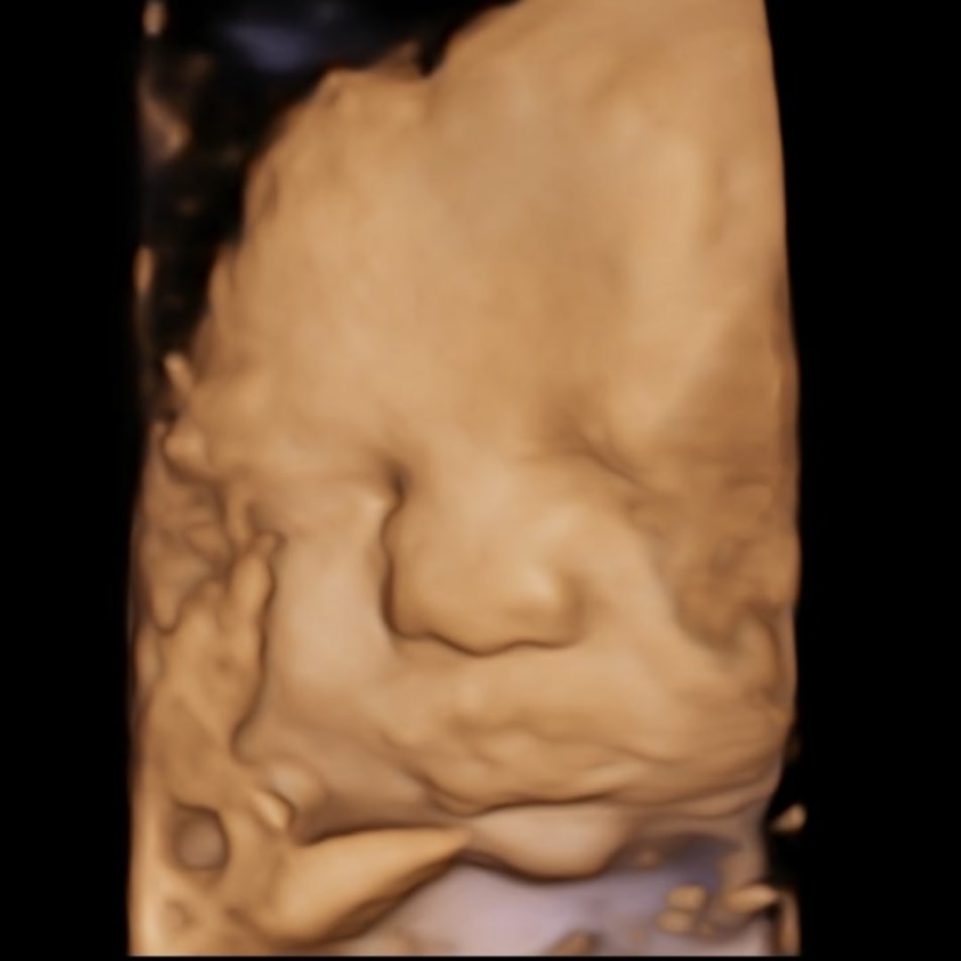 Photo shared by Riley & Gavin for their Babylist baby registry.