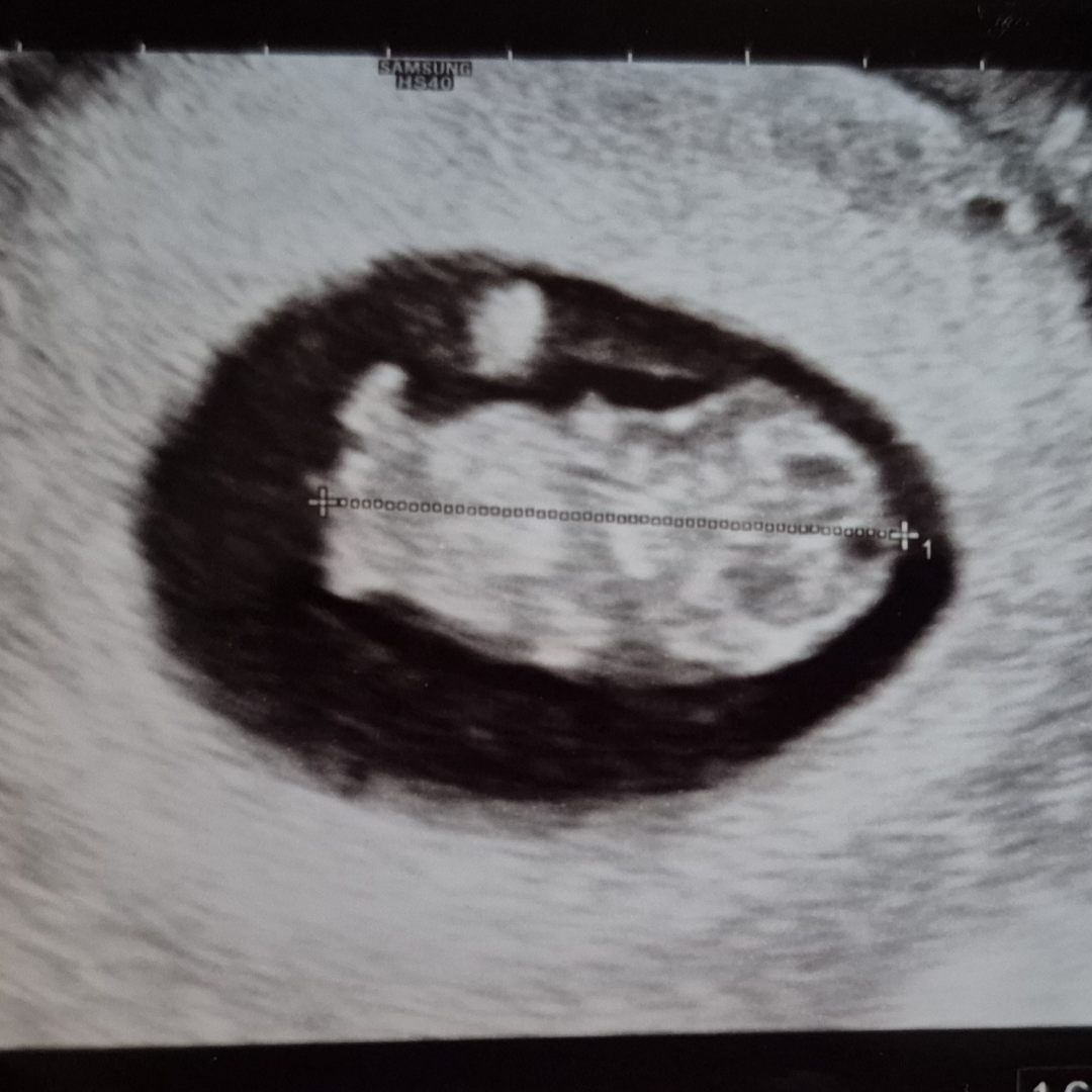 Photo shared by Yosi & Meg for their Babylist baby registry.