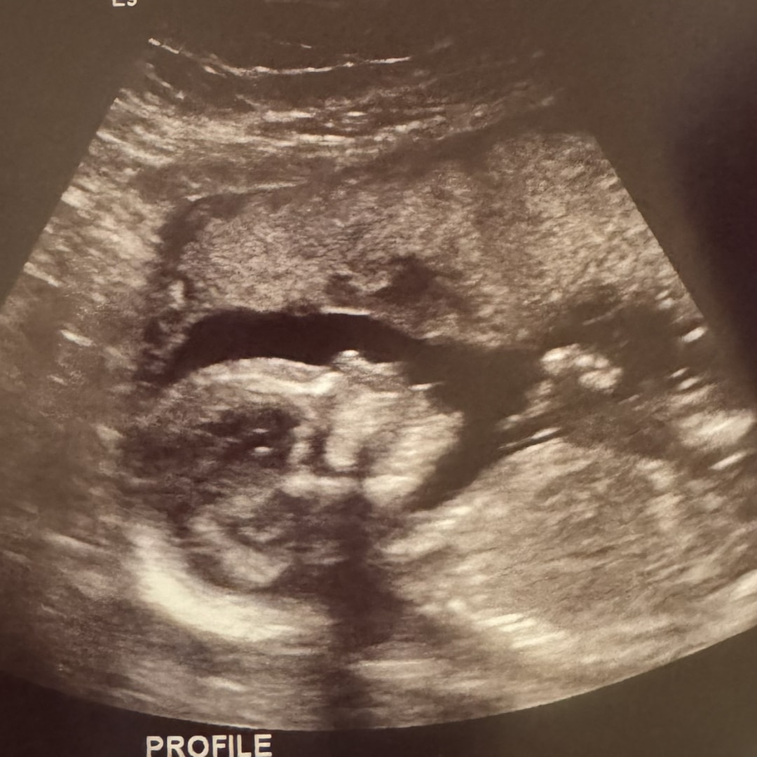 Photo shared by Madalyn for their Babylist baby registry.