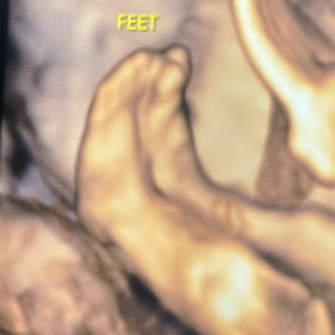 Photo shared by Morgan for their Babylist baby registry.