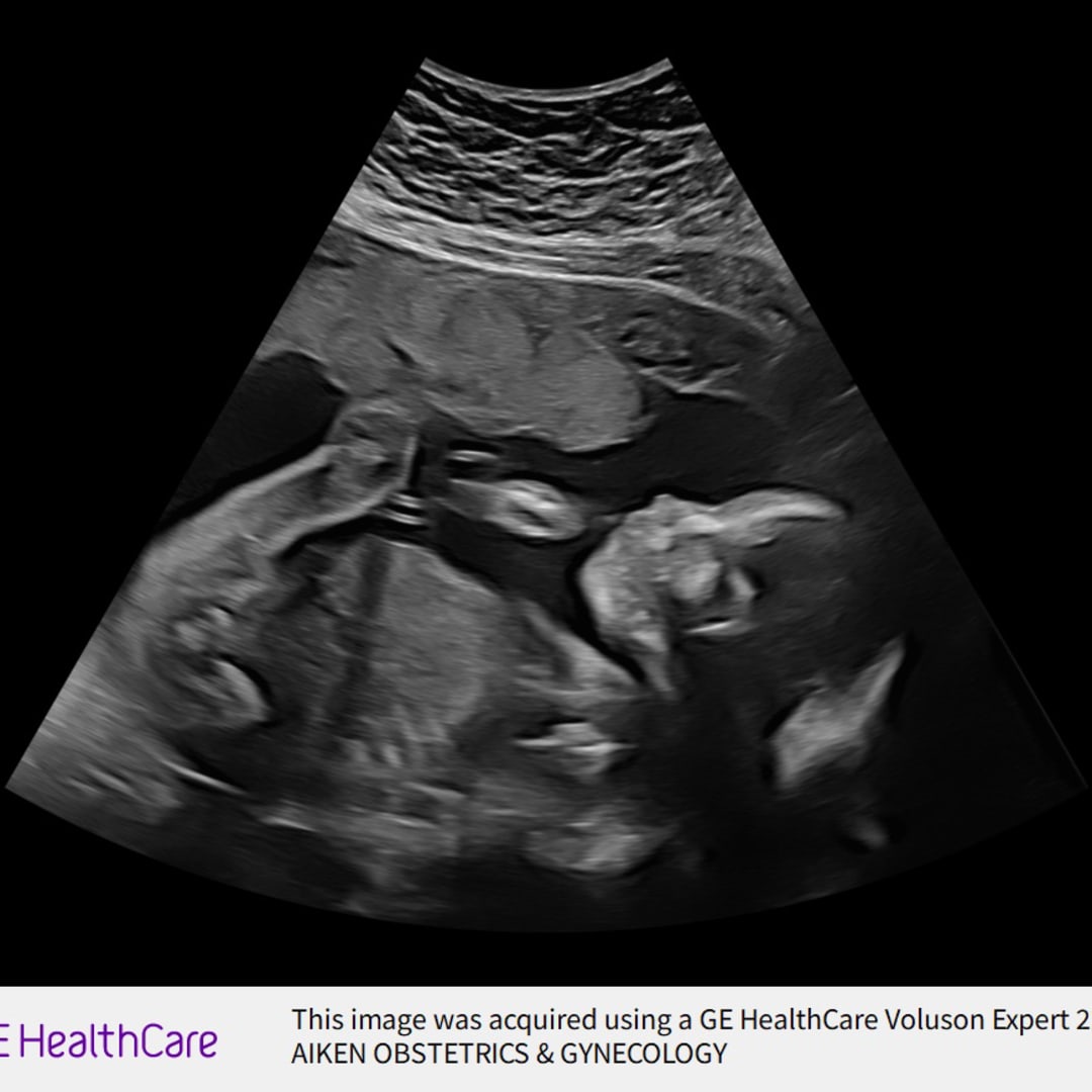 Photo shared by Baylee for their Babylist baby registry.