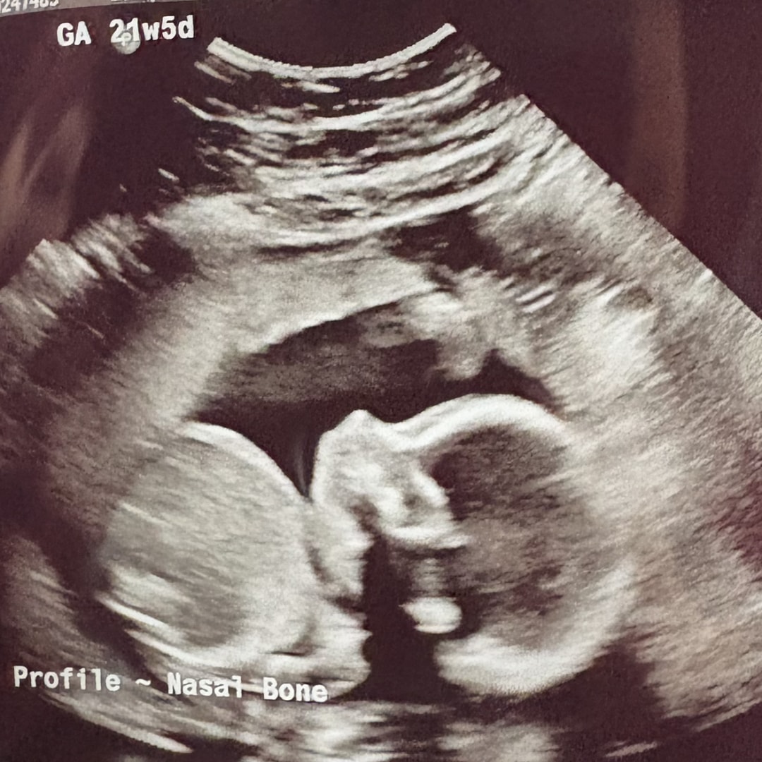 Photo shared by Ivy for their Babylist baby registry.