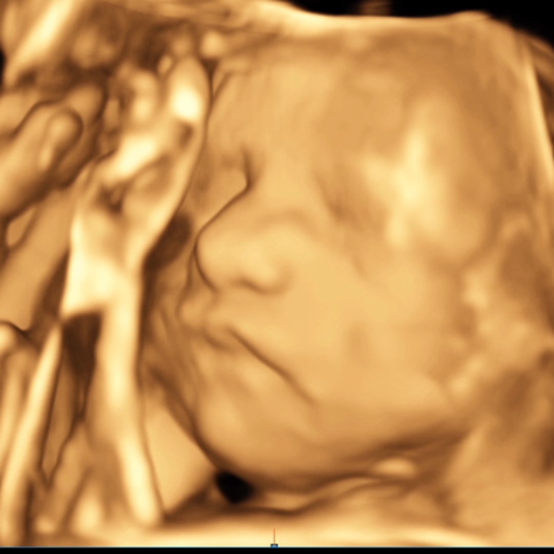 Photo shared by Emily for their Babylist baby registry.