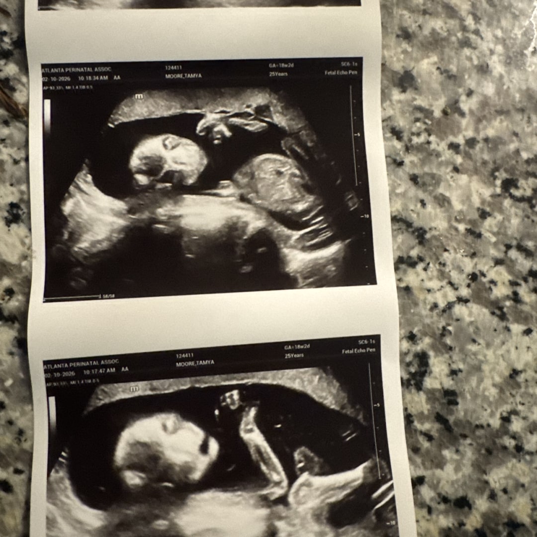 Photo shared by Tamya for their Babylist baby registry.