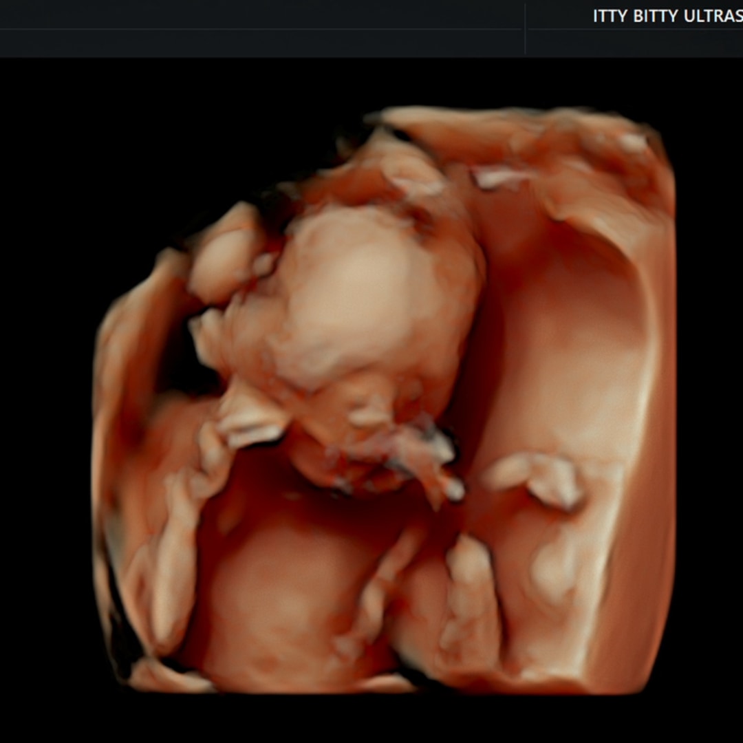 Photo shared by Michelle for their Babylist baby registry.