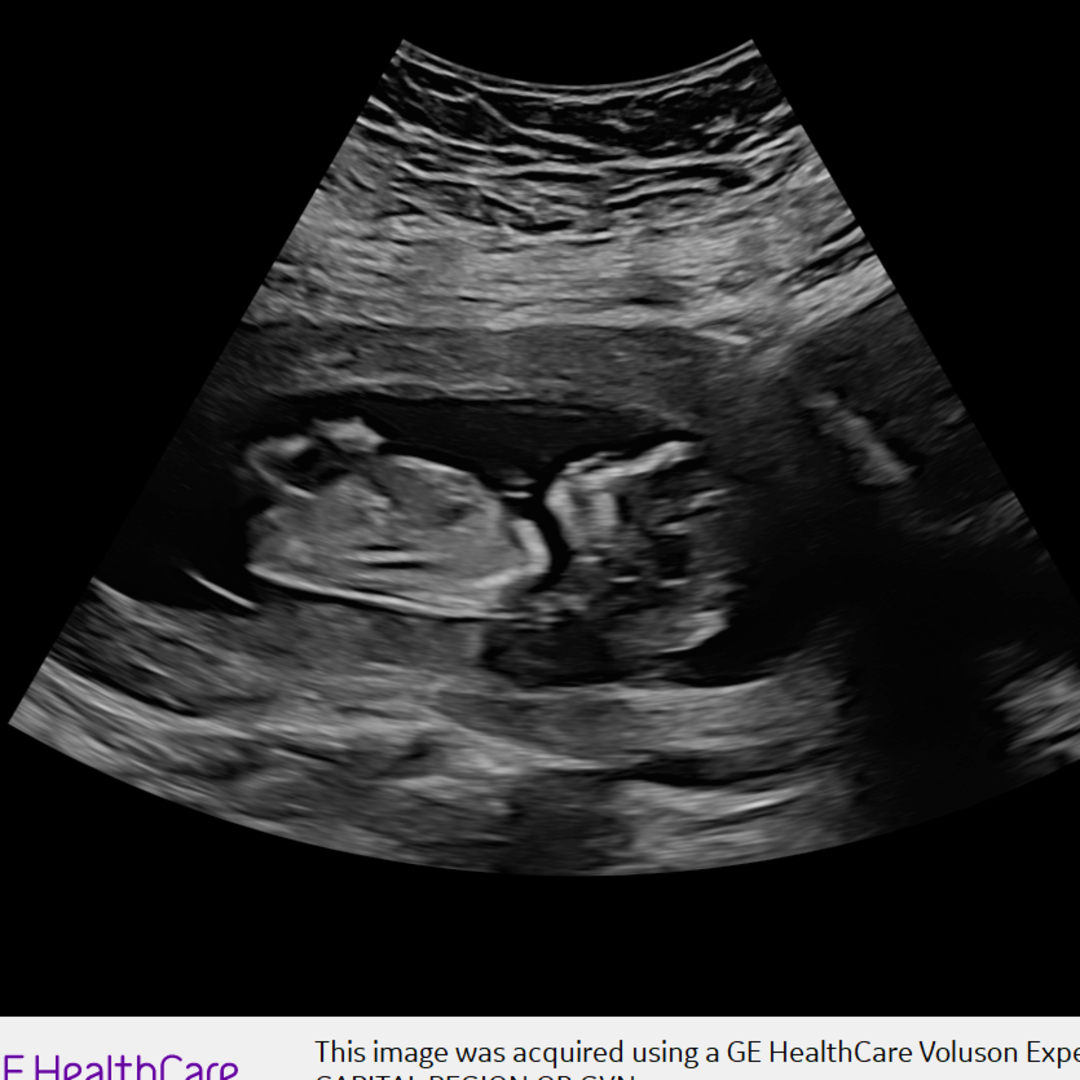 Photo shared by Destinni for their Babylist baby registry.