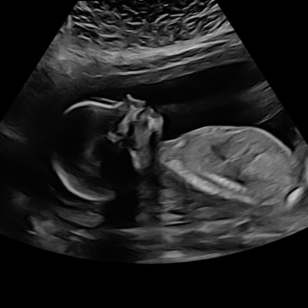 Photo shared by Michelle for their Babylist baby registry.